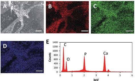  Tricalcium Phosphate: Unlocking Biocompatibility and Osseointegration Potential for Bone Regeneration!